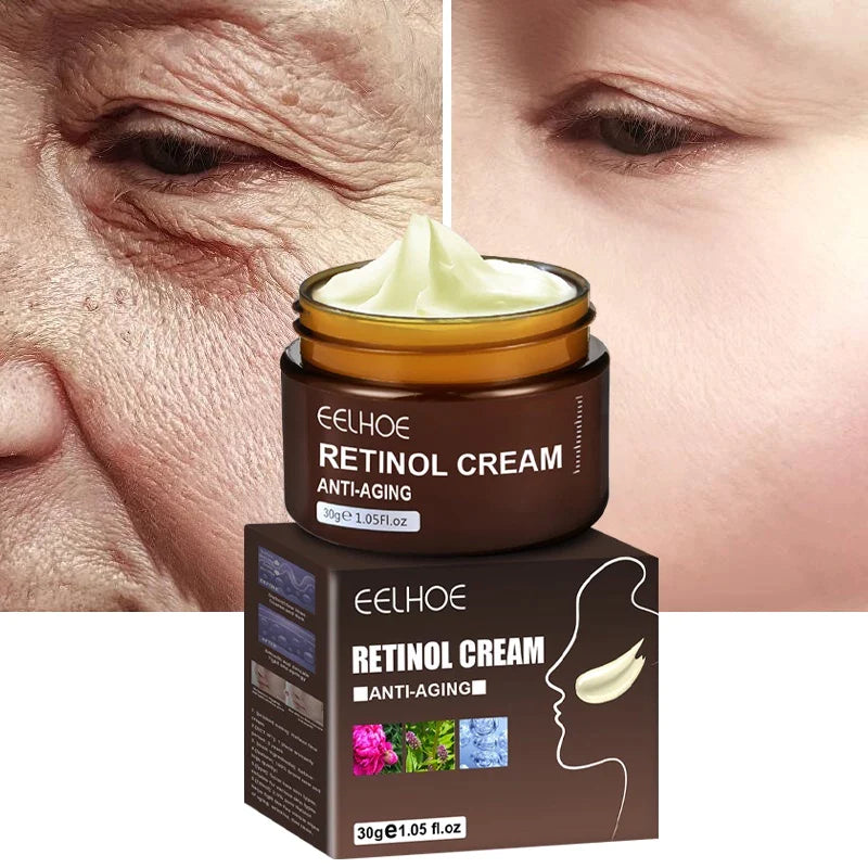 Compre 3 POR MENOS - Retinol Removedor De Rugas,O Creme N°1  Anti-Envelhecimento